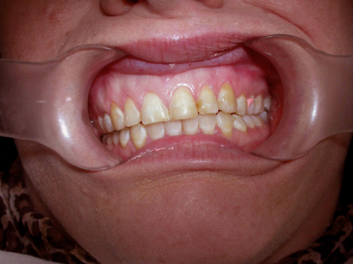 Gallery Midrand Dental Excellence